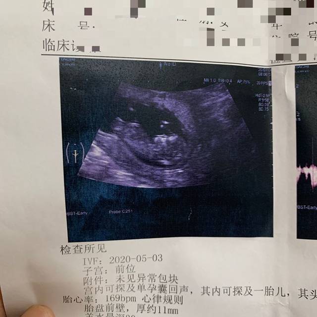 清河县中心医院供卵代怀三代试管科