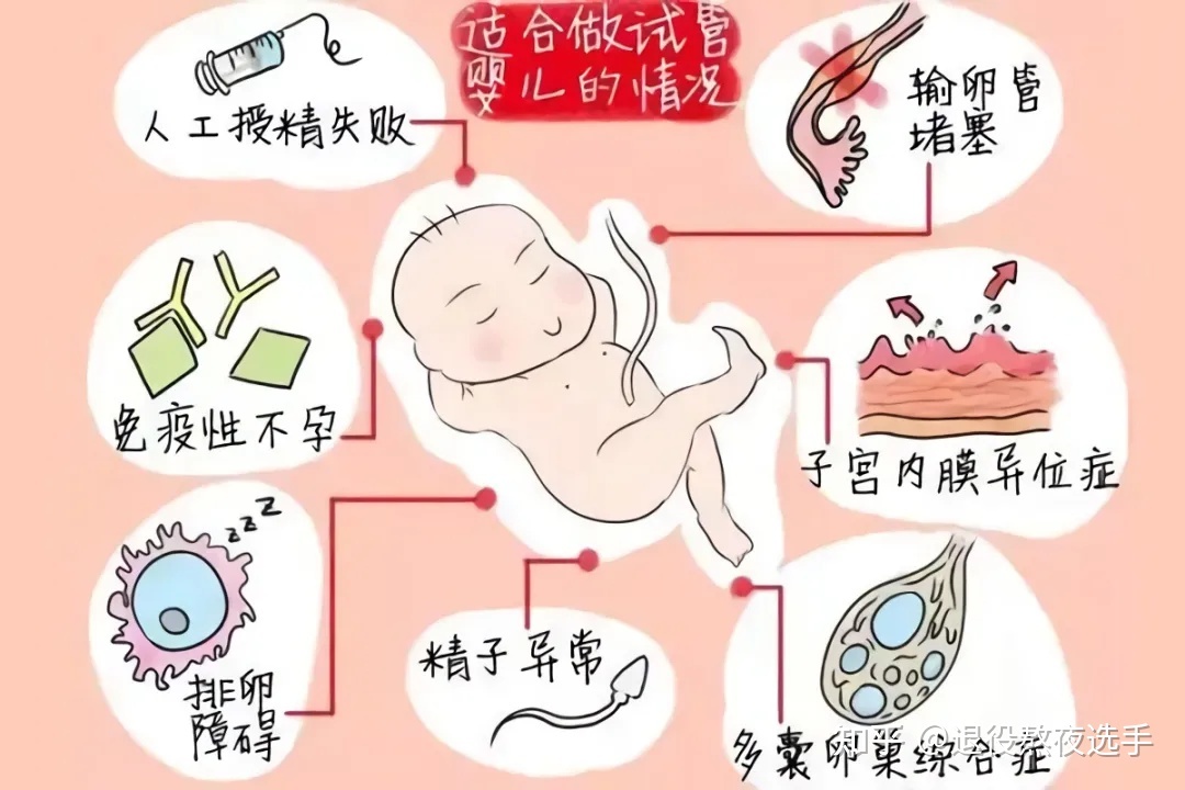 赠卵供卵自怀机构双胎减胎后注意事项