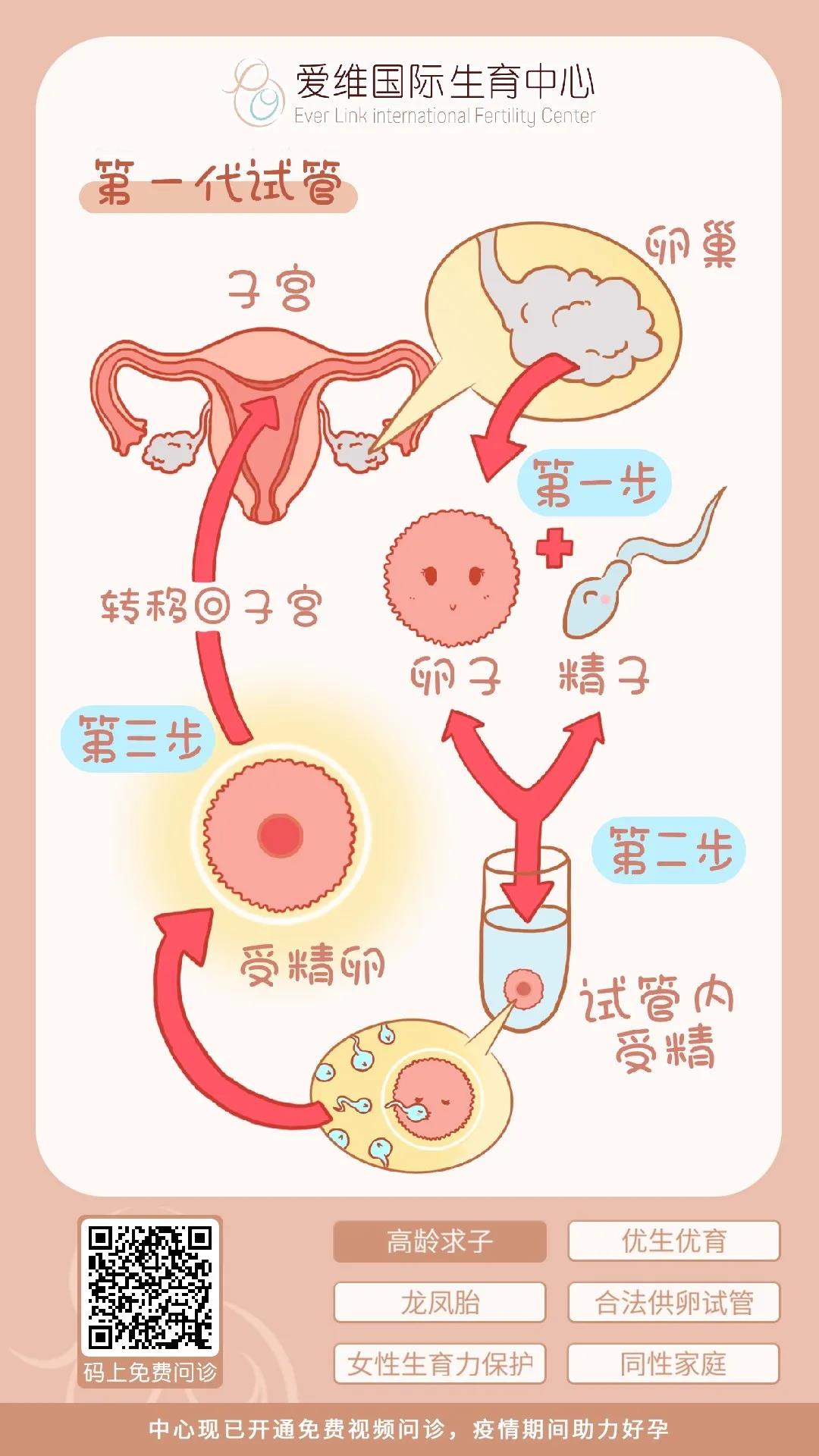 供卵做试管移植2是什么意思