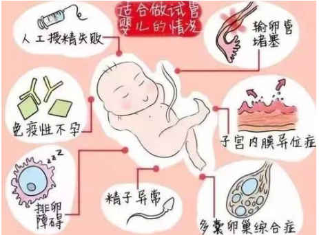 三代赠卵试管移植的是什么胚胎
