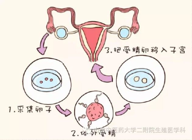 广州能做第三代赠卵试管的助孕代生公司有哪些