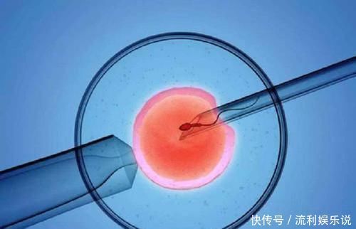 人工受孕好还是试管好那个更好
