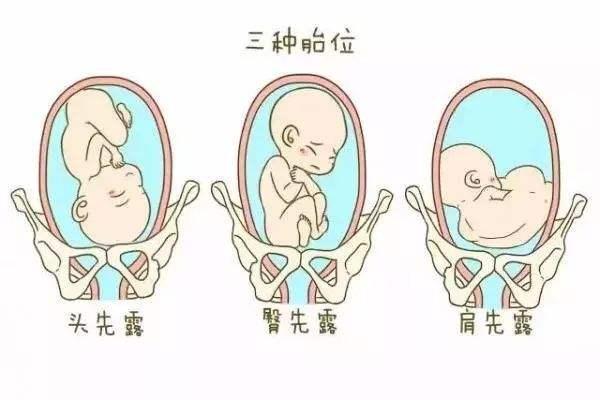 国内借卵代生孩子婴儿的条件有哪些