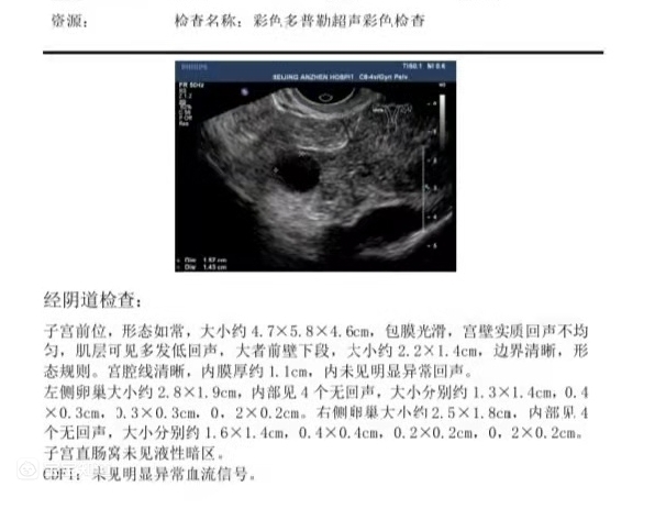 代怀男孩套餐一超是阴超吗_大地试管代怀「毕业超」,究竟是啥意思